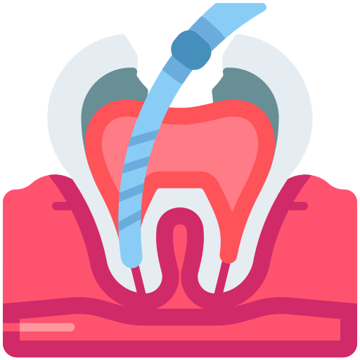 Root Canal