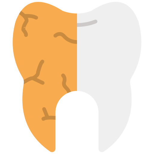 Tooth Decay